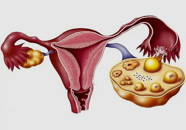 为什么医生会推荐卵巢功能下降患者吃DHEA2.webp.jpg