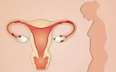 如何应对不断下降的卵巢功能？艾贝贝中医专家为您支招