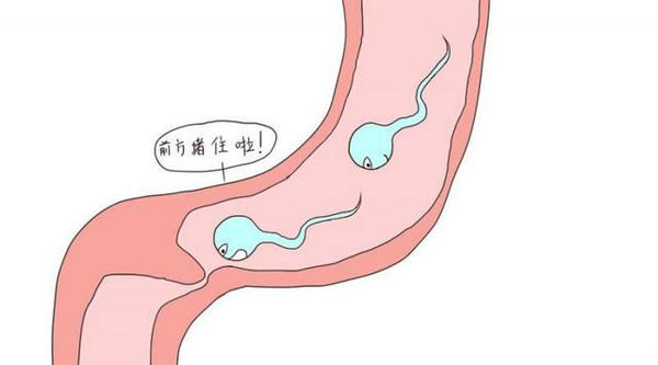 只剩一侧输卵管的女性还能自然怀孕吗2.jpg